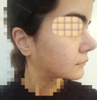 20180317_172420_mh1521345347790.jpg
