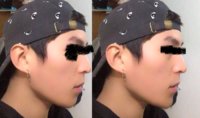 chin profile.jpg