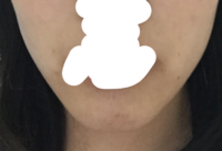 me face 2.png