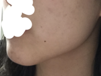 me face 3.png